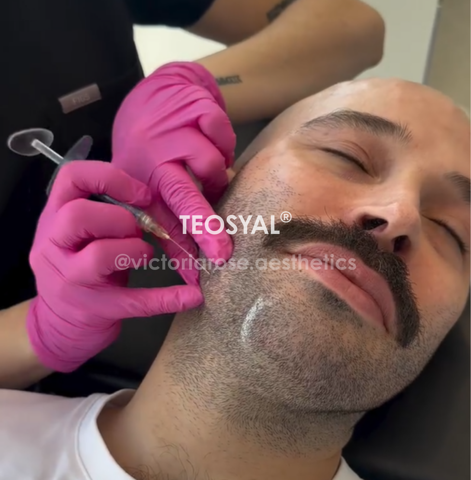 TEOSYAL