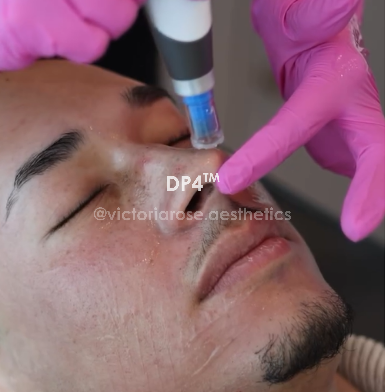 DP4