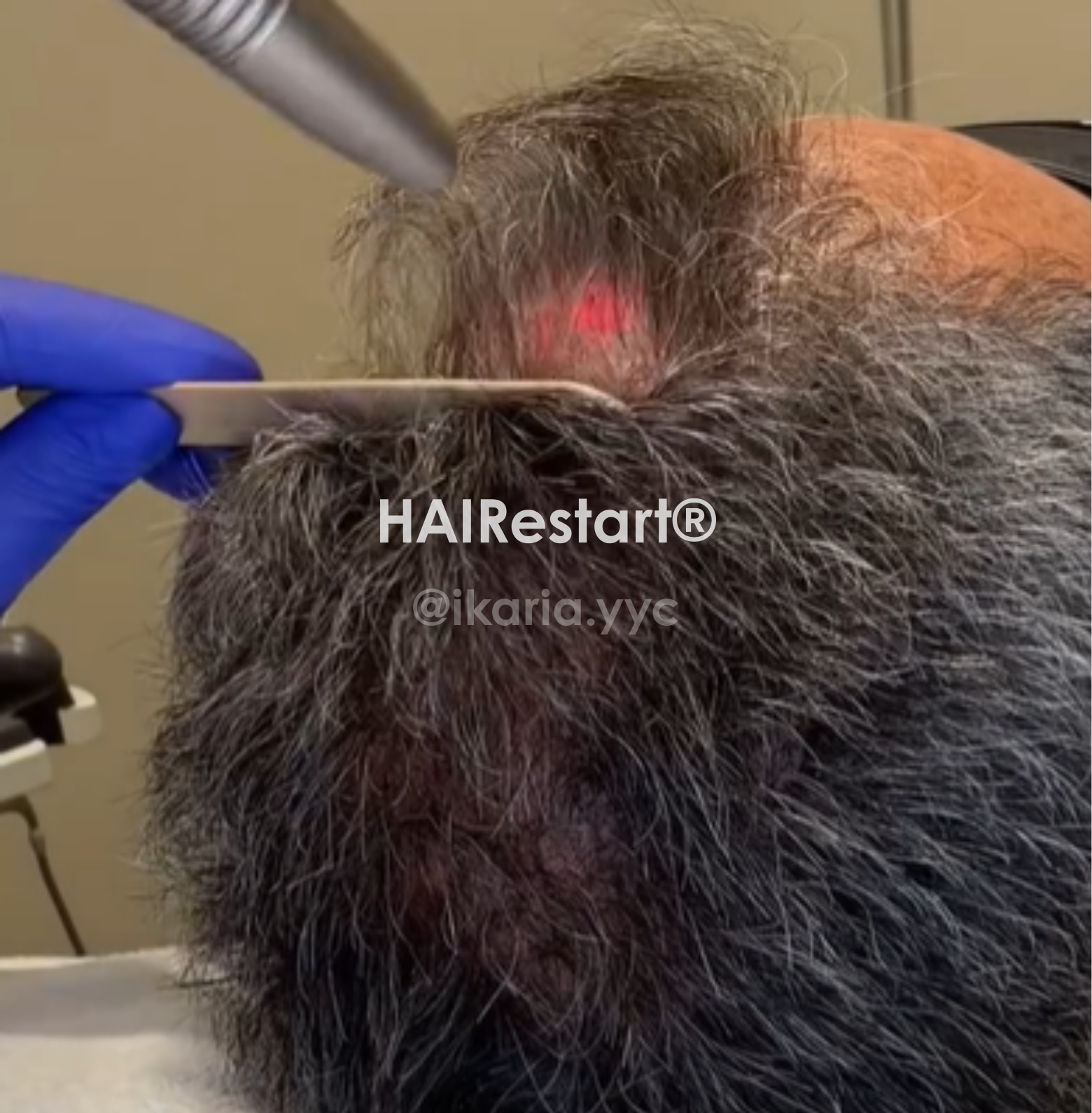 HAIRESTART